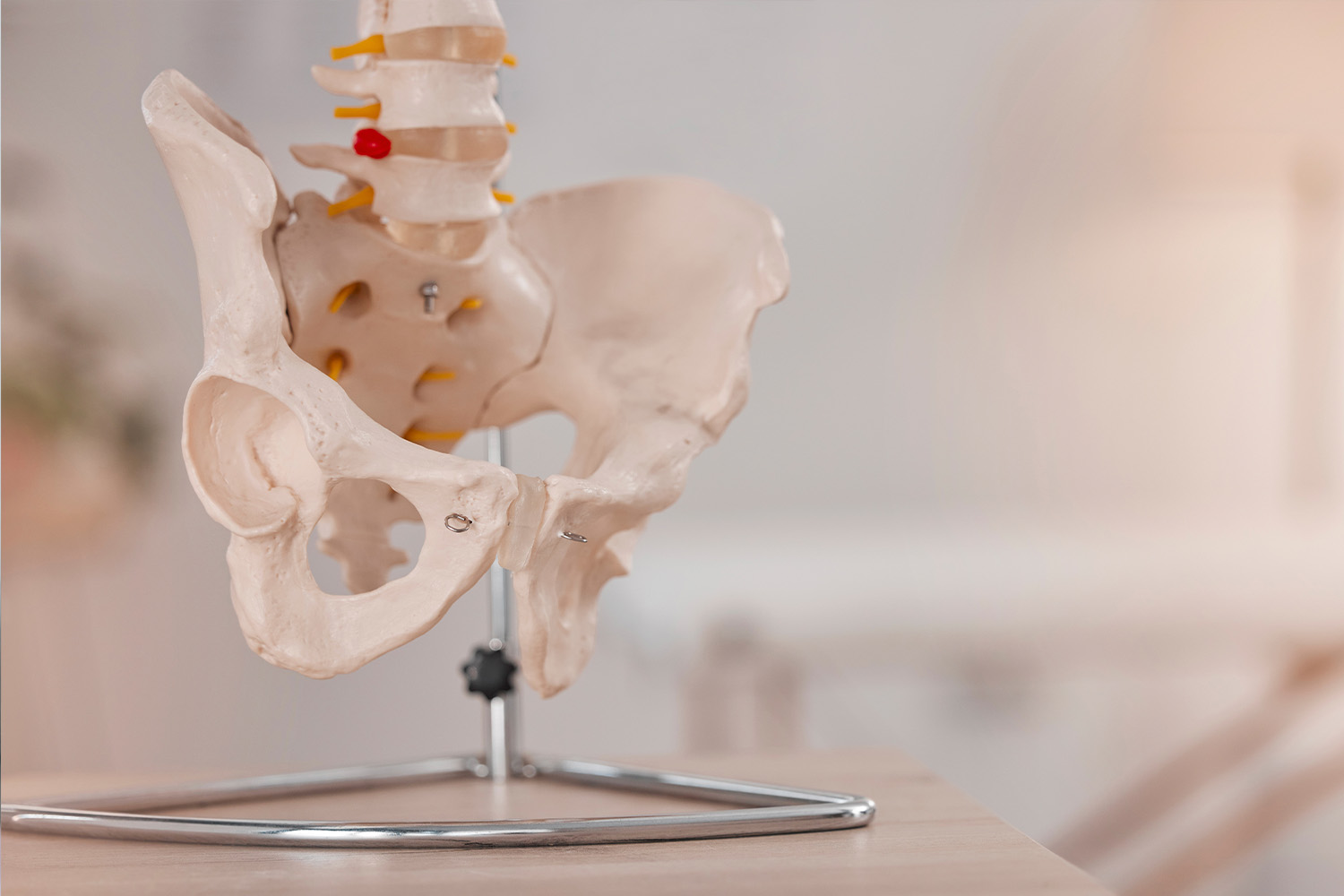 Osteoartrite da Anca