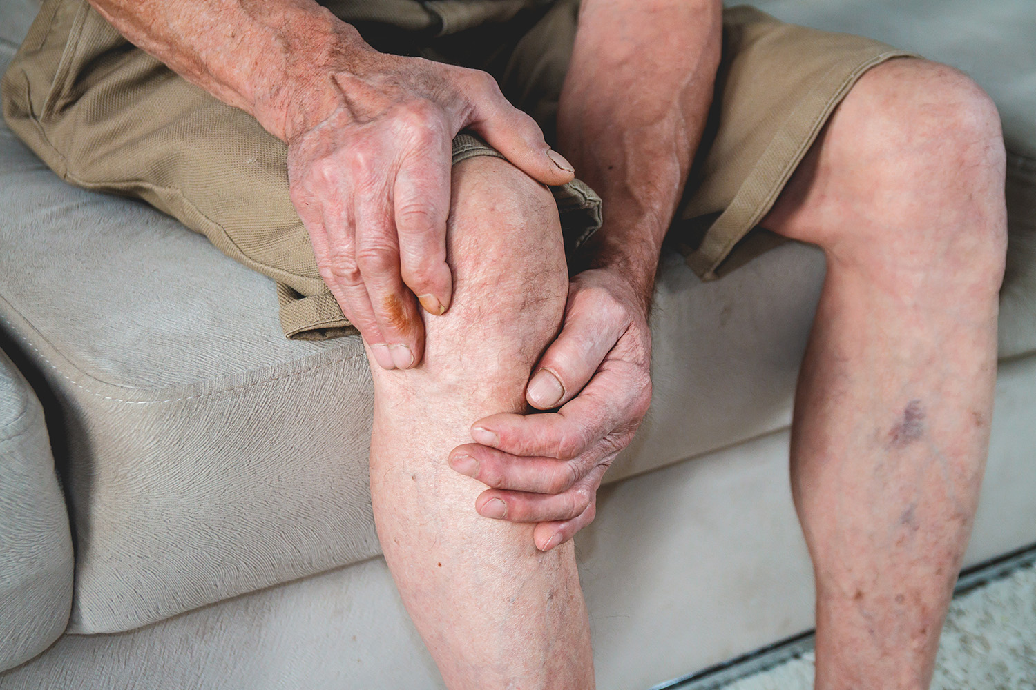 Osteoartrite do joelho